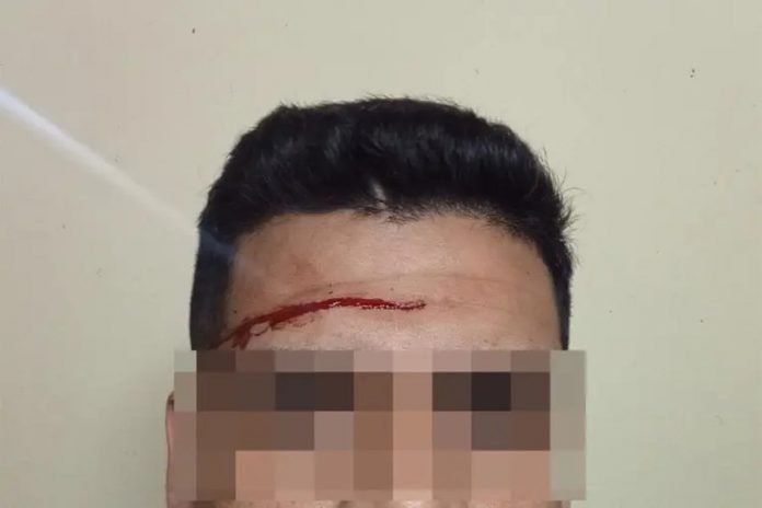 Atacó con un destornillador a un policía en Gualeguaychú