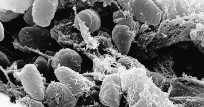 Muerte en un instituto de Siberia: la bacteria de la peste volvió a la mira